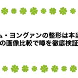 キム・ヨングァンの整形は本当？昔の画像比較で噂を徹底検証！